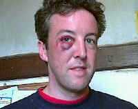 Andy Holdings shiner